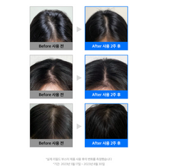 Refilled Cytokine Hair Tonic Booster / 헤어토닉 부스터