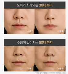 GOLDENDERM GNR Booster Galvanic / 골든덤 지엔알 부스터 갈바닉
