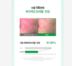 ANUA Trouble Double Care Set (Serum + Cream)