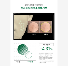 ANUA Trouble Double Care Set (Serum + Cream)