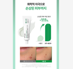 ANUA Trouble Double Care Set (Serum + Cream)