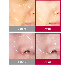 CELLVIAL SKIN PLANING DEEP TOX MASK