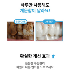 OneWay Oral Irrigator