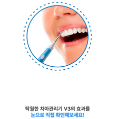OneWay Oral Irrigator