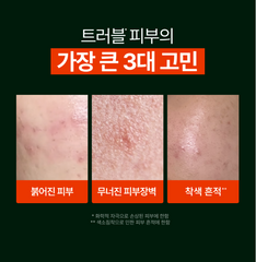ANUA Trouble Double Care Set (Serum + Cream)